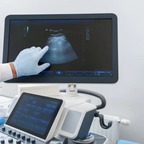 El mejor precio ecocardiograma en cdmx